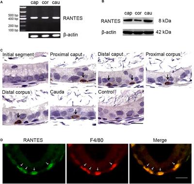 The Involvement of the Chemokine RANTES in Regulating Luminal Acidification in Rat Epididymis